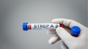 Streptokokas A: simptomai, tyrimas ir gydymas