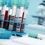 Profilaktiniai sveikatos tyrimai