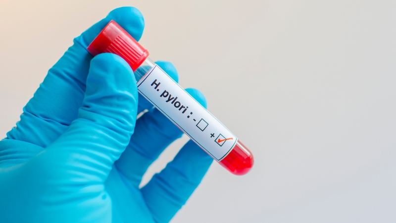 helicobacter pylori testas tyrimas namuose