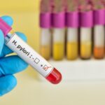 helicobacter pylori tyrimas